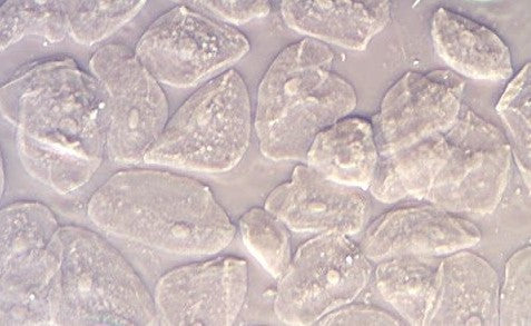 How to set up phase contrast on your microscope