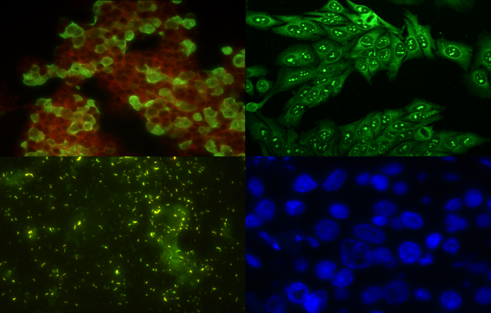 Mshot MF23 Upright Fluorescence Microscope - additional MSHOT product image